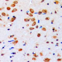AKT1 + AKT2 + AKT3 Antibody (phospho-Tyr315)