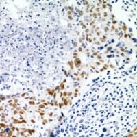 Polyclonal Rabbit anti-Human UBC / Ubiquitin C Antibody (IHC, WB)