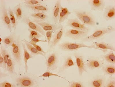 Polyclonal Rabbit anti-Human HIST1H3A Antibody (IHC, IF)