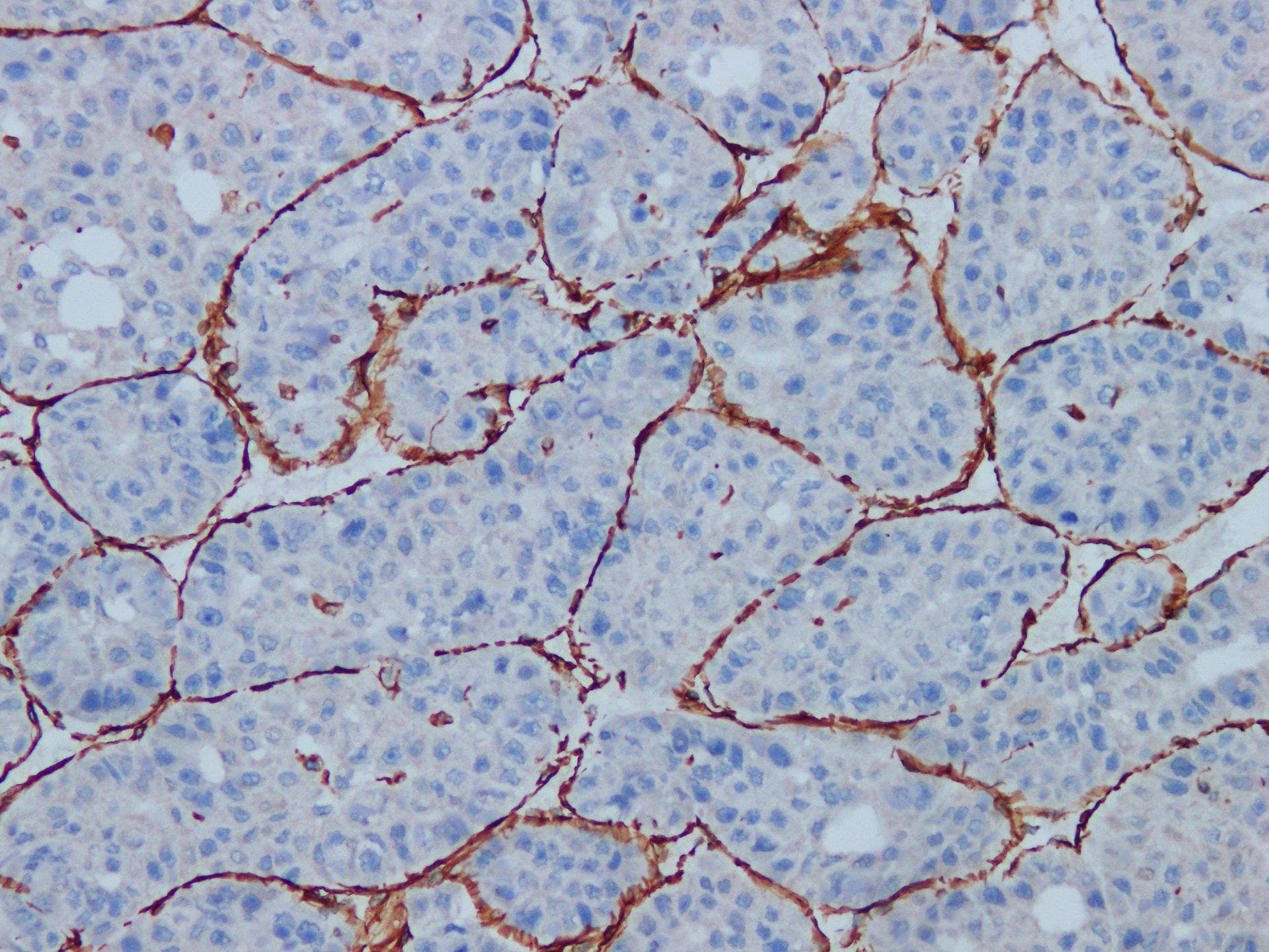 Vimentin Antibody