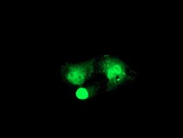 Monoclonal Mouse anti-Human RFXANK Antibody (clone OTI2B6, IHC, IF, WB)