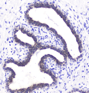 BTC / Betacellulin Antibody