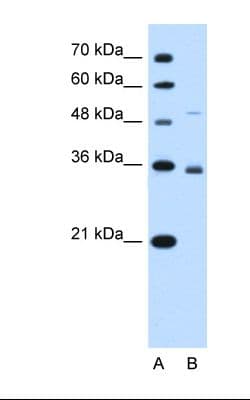 SLC38A3 / SNAT3 Antibody (aa31-80)
