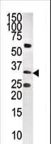 CTDSP1 / SCP1 Antibody (aa235-261)