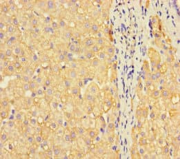 METTL7A Antibody