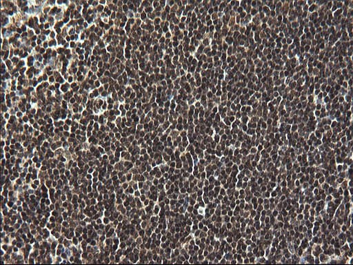 RPRD1B Antibody (clone OTI1C9)