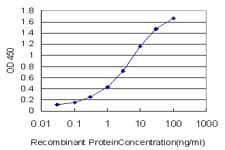 IHC-plus™ Monoclonal Mouse anti-Human GSN / Gelsolin Antibody (clone 3G5, IHC, WB)