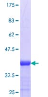 Human ADAMTS18 Protein (Recombinant GST, N-terminus)