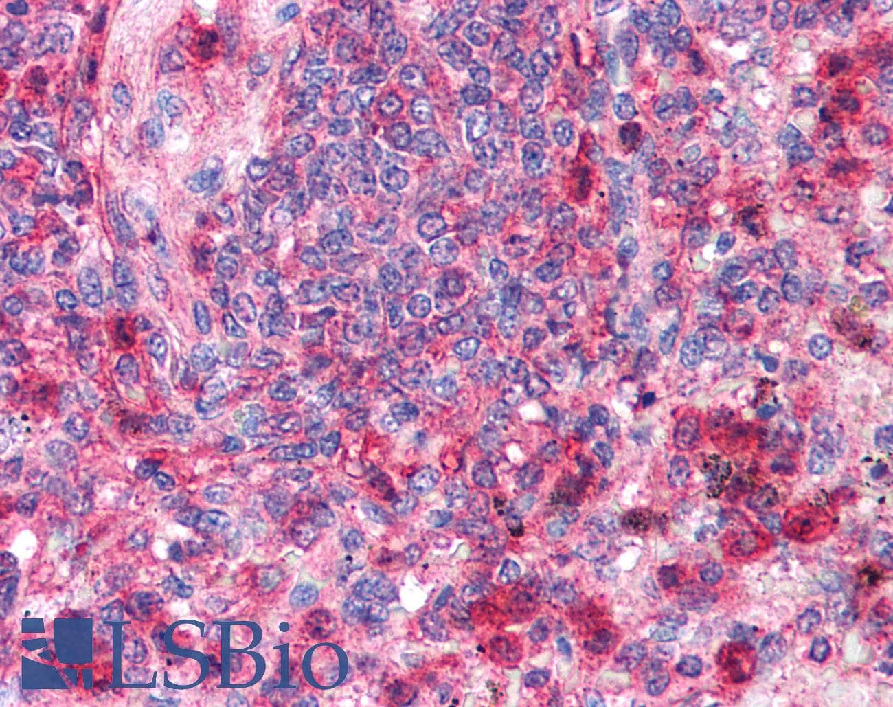 IHC-plus™ Polyclonal Rabbit anti-Human TRAF6 Antibody (IHC, IF, WB)