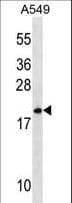 Polyclonal Rabbit anti-Human MRPL40 Antibody (aa172-200, WB)