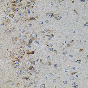 MAPK11 / SAPK2 / p38 Beta Antibody (AP)