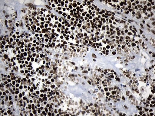 Monoclonal Mouse anti-Human POLR2A / RNA polymerase II Antibody (clone OTI3C8, aa1351-1614, IHC, WB)