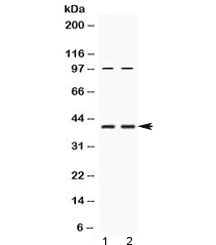 RPSA / Laminin Receptor Antibody