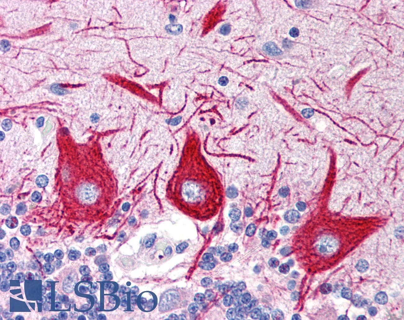IHC-plus™ Polyclonal Rabbit anti-Human SLC15A1 / PEPT1 Antibody (C-Terminus, IHC, WB)