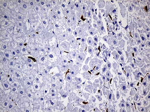 Monoclonal Mouse anti-Human CD68 Antibody (clone OTI2E2, aa22-319, IHC, WB)