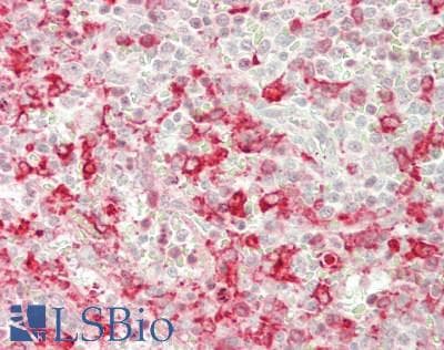 IHC-plus™ TS / Thromboxane Synthase Antibody