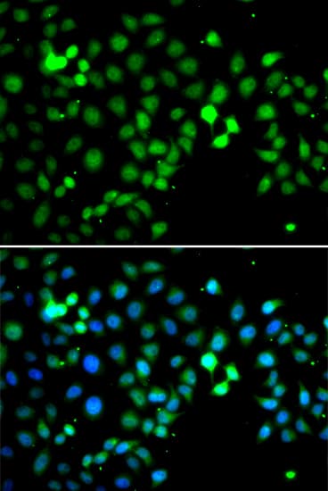 Polyclonal Rabbit anti-Human MTF2 / PCL2 Antibody (IHC, IF, WB)