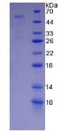 Mouse PAPPA / PAPP-A Protein (Recombinant His-GST, N-terminus)