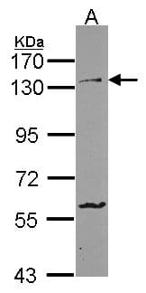 Polyclonal Rabbit anti-Human PCDH1 / PCD1 Antibody (aa710-971, IHC, WB)