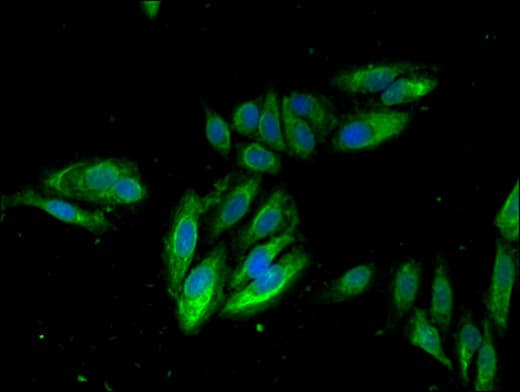ITGB2 / CD18 Antibody
