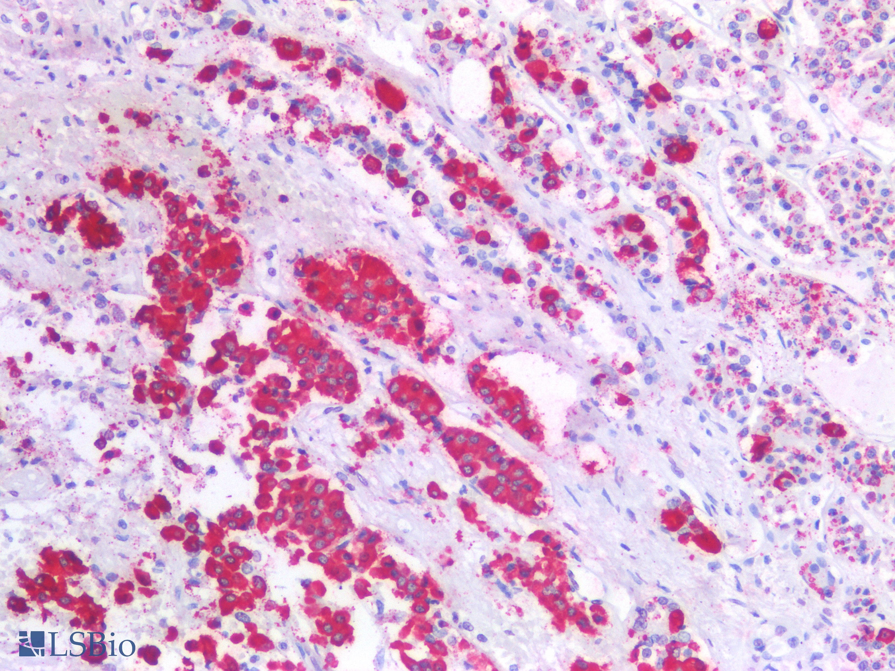 PathPlus™ Monoclonal Mouse anti-Human ACTH Antibody (IHC)