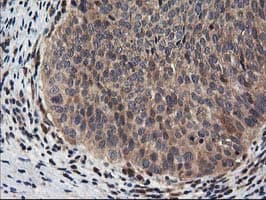 NUDT18 Antibody (clone OTI5F9)