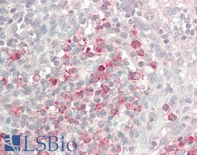 IHC-plus™ GPR174 Antibody (aa118-167)