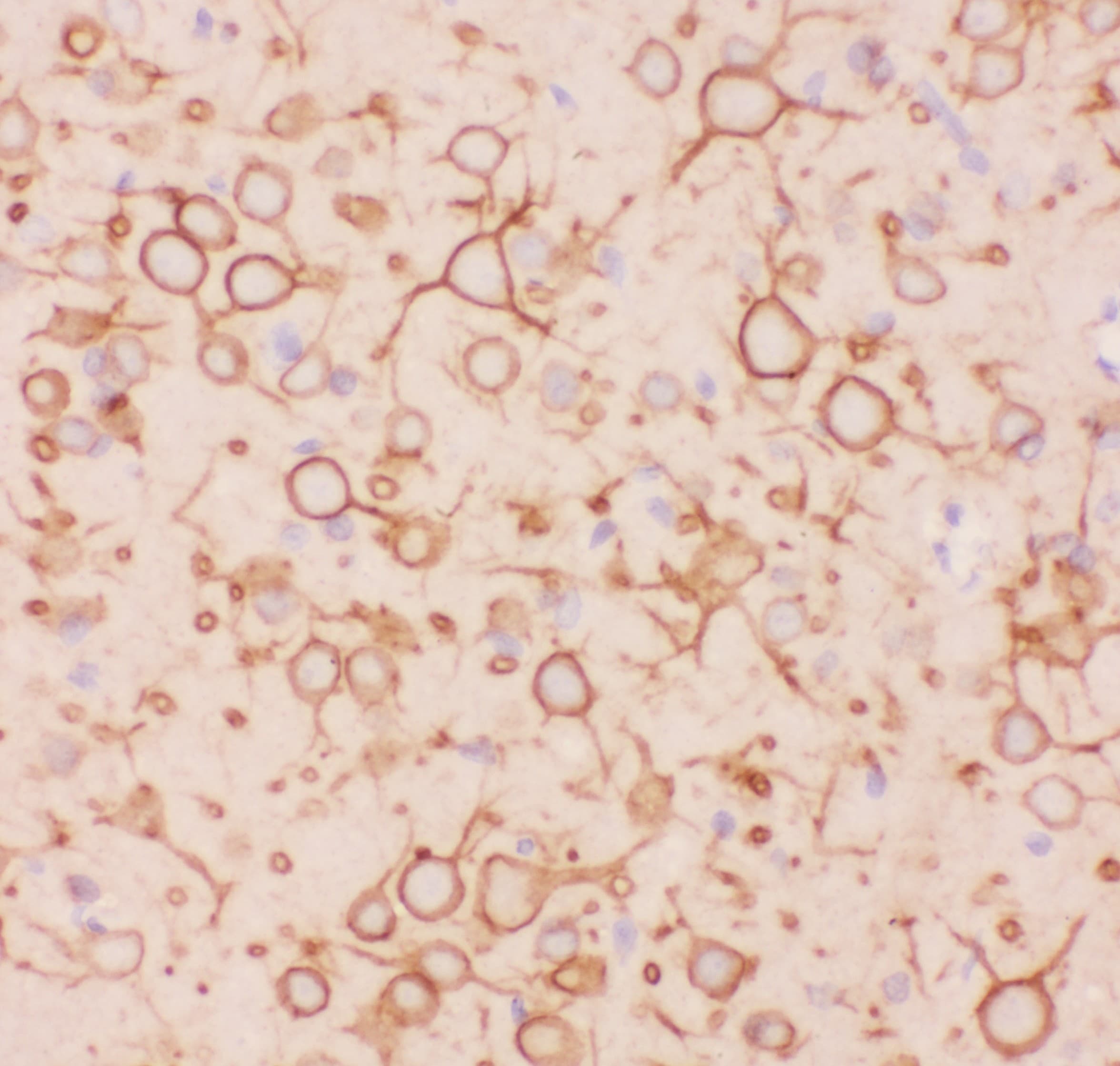KCNB1 / Kv2.1 Antibody (aa687-858)