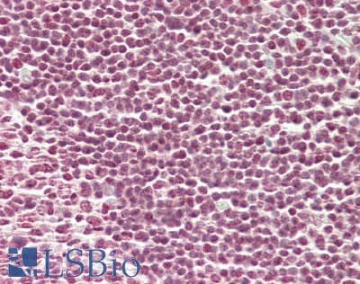 IHC-plus™ ELL / MEN Antibody (aa150-200)