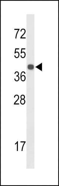 IHC-plus™ CENPK Antibody (aa239-266)
