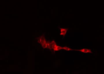 CILD9 / DNAI2 Antibody