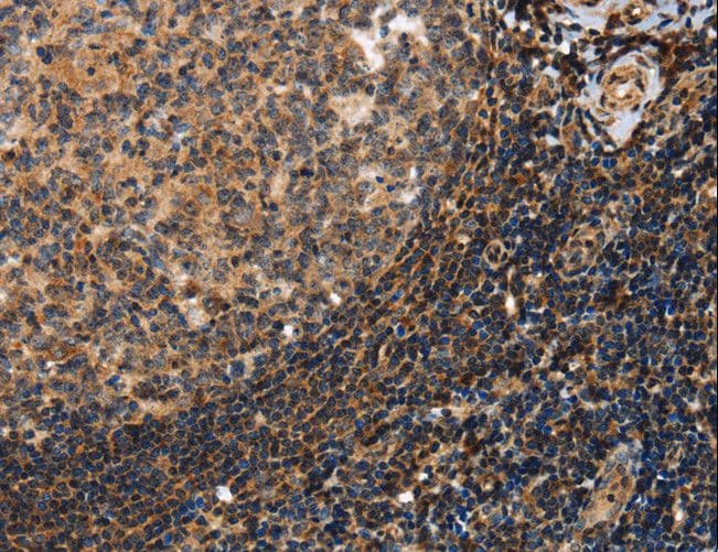 PON1 / ESA Antibody