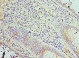 TAB1 Antibody (aa205-504)