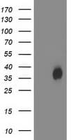 Monoclonal Mouse anti-Human HDHD2 Antibody (clone OTI 3A12, WB)