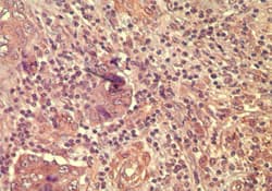 Polyclonal Rabbit anti-Human WNT5A Antibody (aa190-230, IHC, WB)