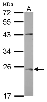 Polyclonal Rabbit anti-Human C1orf146 Antibody (WB)