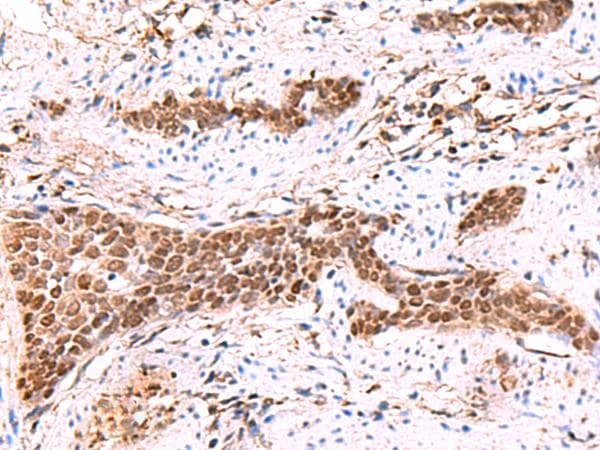 Polyclonal Rabbit anti-Human SOX2 Antibody (IHC, WB)
