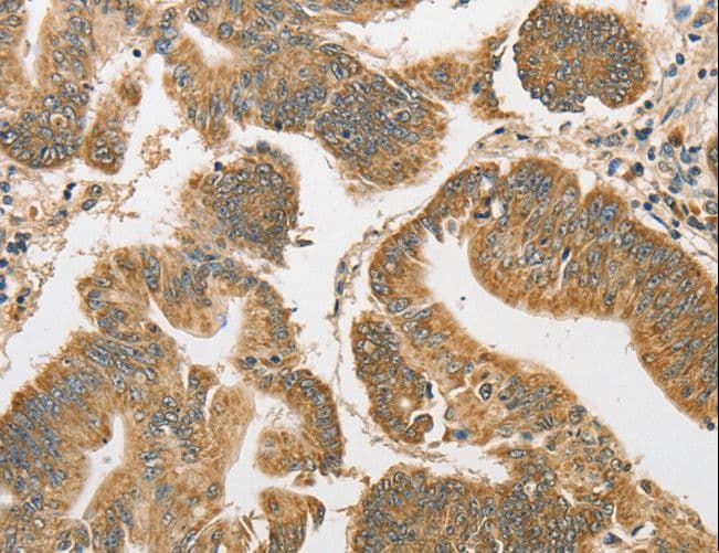 ATG3 Antibody