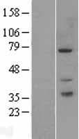 Human PAK6 Protein (Over-Expression Lysate Myc-DDK (Flag))