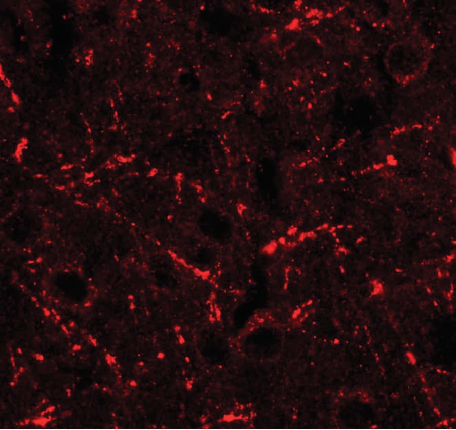 IHC-plus™ CCL4 / MIP-1 Beta Antibody