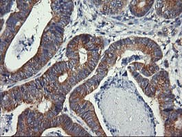 DNM1L / DRP1 Antibody (clone OTI4F6)