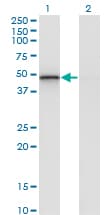 RCN2 Antibody (clone 1A9)