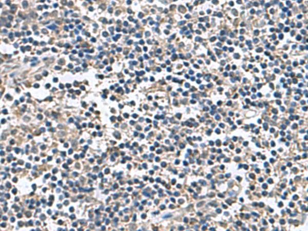 PLDN / Pallidin Antibody