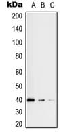 Polyclonal Rabbit anti-Human RFC3 Antibody (Internal, IHC, WB)