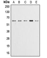 AKT1 + AKT2 + AKT3 Antibody (phospho-Tyr315)