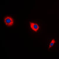 Polyclonal Rabbit anti-Human BAX Antibody (Internal, IHC, IF, WB)