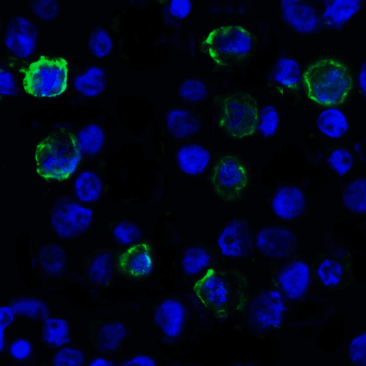 IHC-plus™ Monoclonal Mouse anti-Human VSIR / GI24 / VISTA Antibody (clone 4C4, IHC, IF, WB)