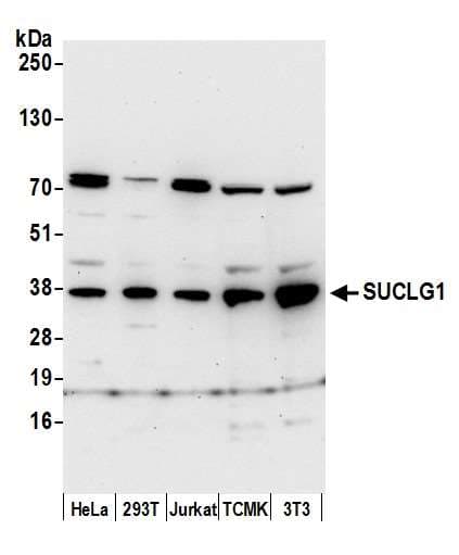 Polyclonal Rabbit anti-Human SUCLG1 / GALPHA Antibody (aa296-346, WB)