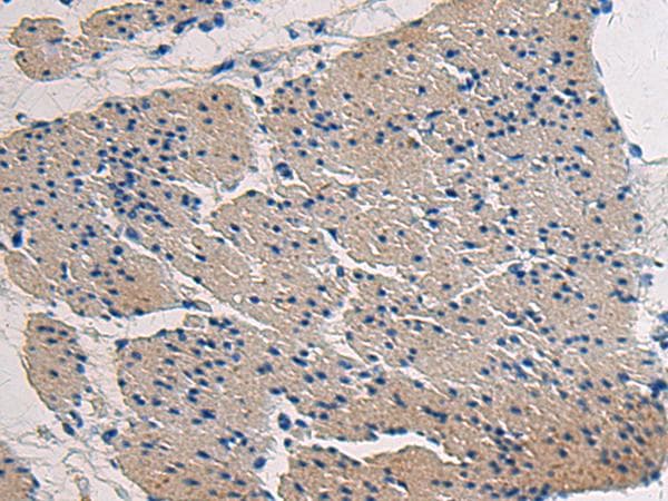 COL17A1 / Collagen XVII Antibody
