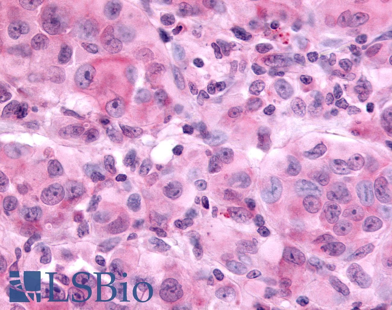 PathPlus™ EAR2 / NR2F6 Antibody (N-Terminus)